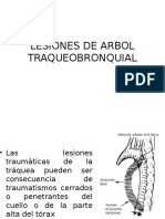 Lesiones de Arbol Traqueobronquial