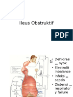 Ileus Obstruktif