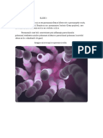  Definitia pneumoniei pneumococice -model slide