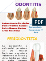 PERIODONTITIS