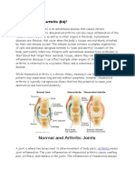 What Is Rheumatoid Arthritis