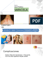 Varicela Sof