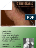 Candidiasis Mikologi