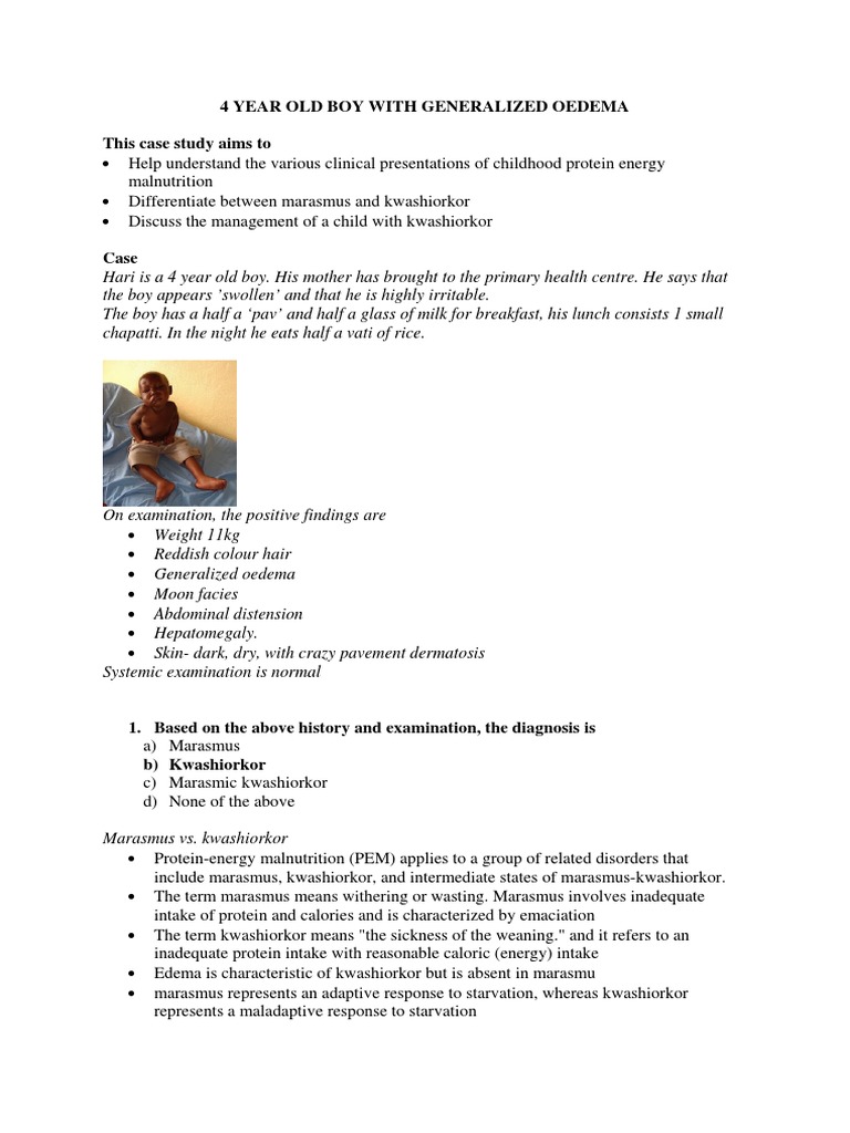 Case report on severe acute malnutrition image