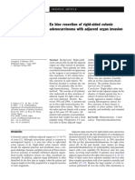 En Bloc Resection of Right-sided Colonic Adenoca - Kapoor2005