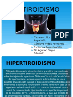 HIPERTIROIDISMO Etiologia