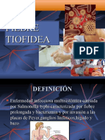 Fiebre Tifoidea Laura Aguilar Perez