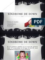 Sindrome de Down