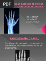 Edad Ósea Radiológica 2 | PDF | Mano | Hueso
