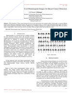 The Preprocessing Methods of Mammogram Images For Breast Cancer Detection