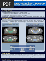 VMAT NO TRATAMENTO NEOADJUVANTE DO RETO