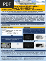 Radioterapia na Histiocitose de Células de Langerhans