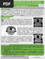Metástase coroideia de tumor da mama