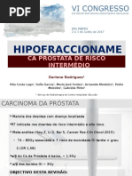 Hipofraccionamento no Carcinoma da Próstata de Risco Intermédio
