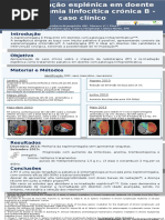 Re-irradiação esplénica em doente com leucemia linfocítica crónica B - caso clínico 