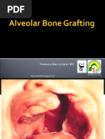 Download Alveolar Bone Grafting by Frederick Mars Untalan SN35000761 doc pdf