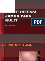 Askep Infeksi Jamur