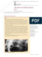 Caso Clínico. Una Mujer de 68 Años Con Dolor Dorsal de Reciente Inicio PDF