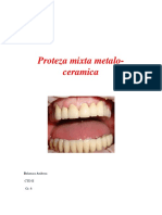 Proteza-Mixta-Metalo-Ceramica.pdf