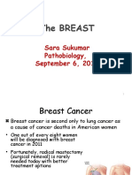 Breast Cancer Sukumar