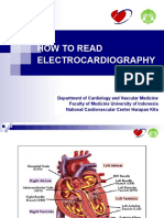 ECG Interpretation