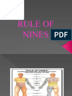 The Rule of Nines