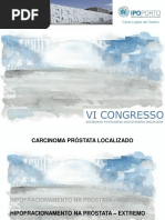 HIPOFRACIONAMENTO NA PRÓSTATA – EXTREMO