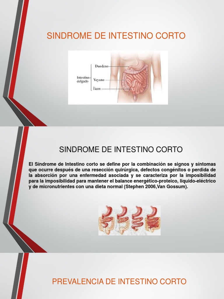 Sindrome de Intestino Corto Listo Diarrea Gastroenterología