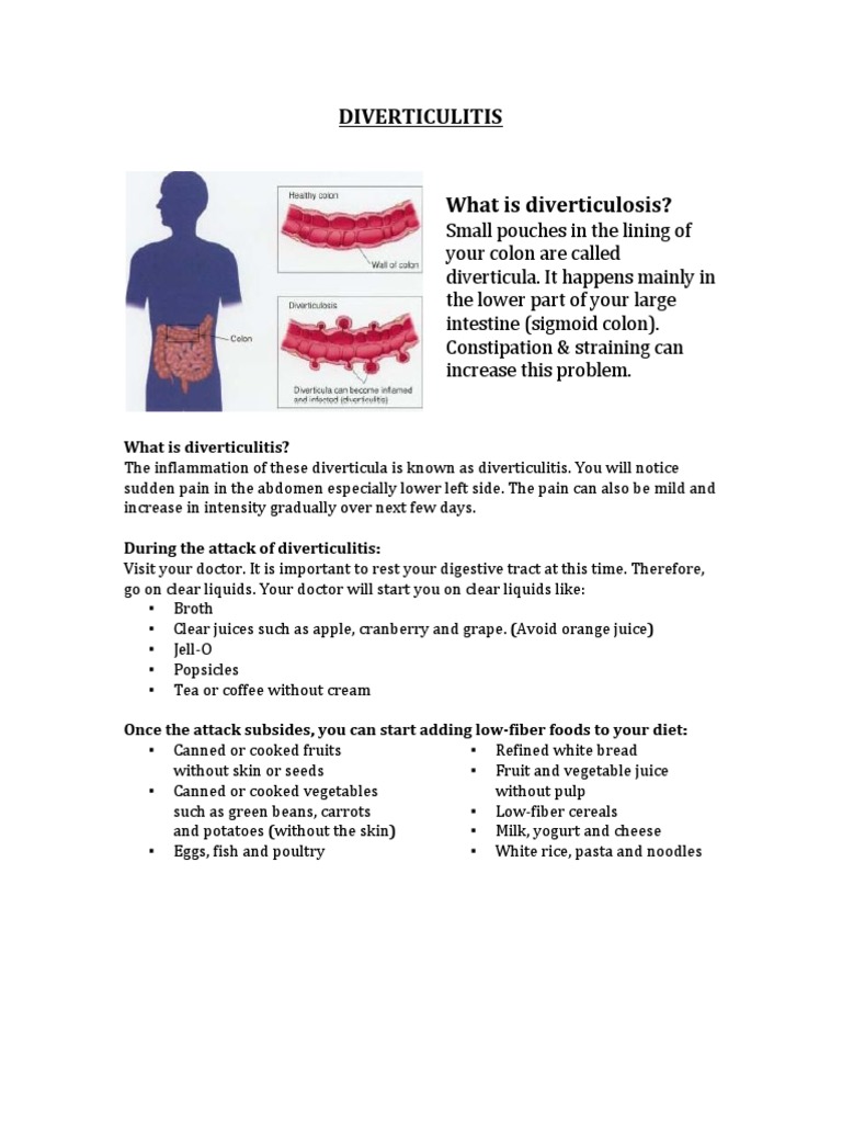 diverticulitis docx Dietary Fiber Nutrition