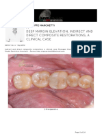 Giuseppe Marchetti Deep Margin Elevation Indirect and Direct Composite Restorations A Clinical Case Via