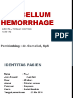 Cerebellum Hemorrhage CBD DR - Terry