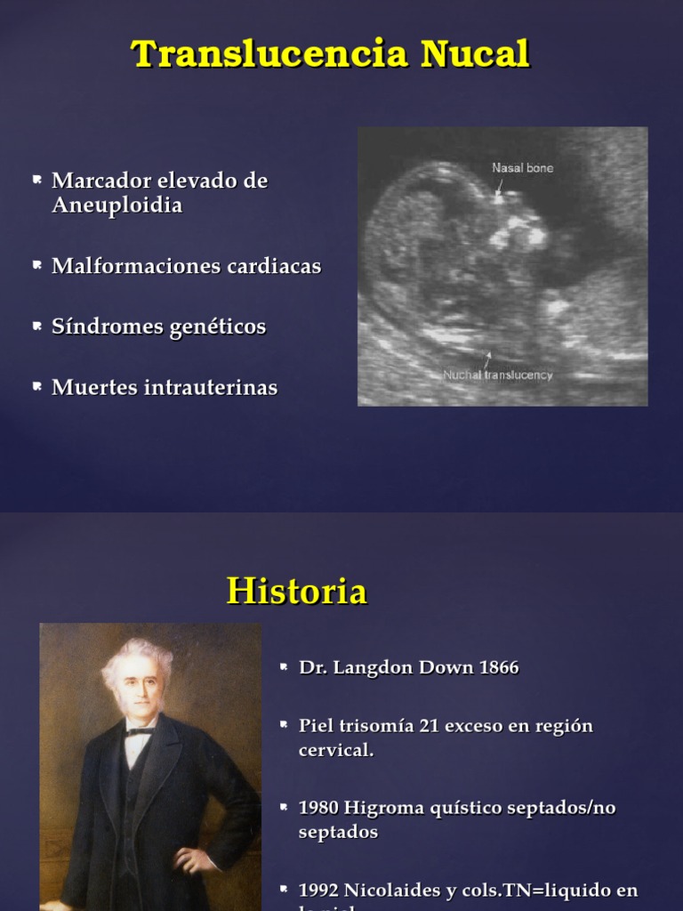 Translucencia Nucal | PDF | Feto | Corazón