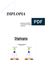 Diplopía: causas, síntomas y tratamiento