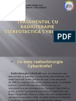 Tratamentul Cu Radioterapie Stereotactică Cyberknife