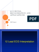 ECG Signal