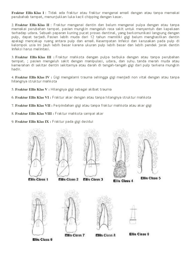 Klasifikasi Fraktur Gigi Ellis | PDF