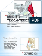 Bursitis Trocanterica