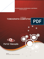tomografiacomputadorizada01-140708161014-phpapp01