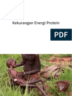 Kekurangan Energi Protein.pptx