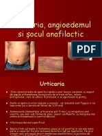 Urticarie, Angioedem, Soc Anafilactic