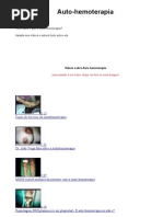 Você sabe o que é Auto-hemoterapia?  Assista aos vídeos e saberá tudo sobre ela.