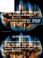 Quemaduras Eléctricas y El Gran Quemado