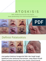 Palatoskisis