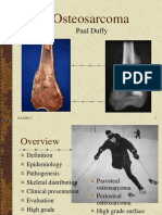 Osteosarcoma