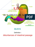 ILEUS