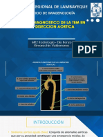 Valor Diagnóstico de La Tomogarafía en La Disección Aórtica