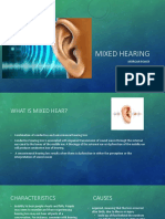 Mixed Hearing