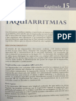 Taquiarritmias PDF