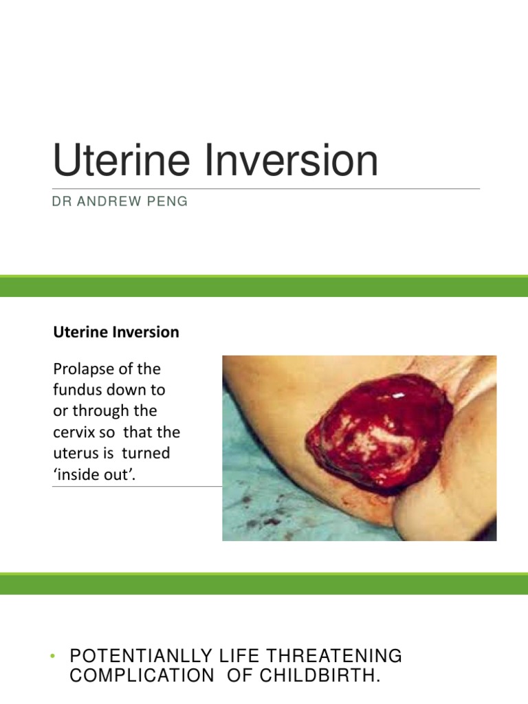 Uterine Inversion1 Pdf Uterus Human Reproduction