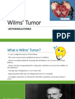 Wilm's Tumor